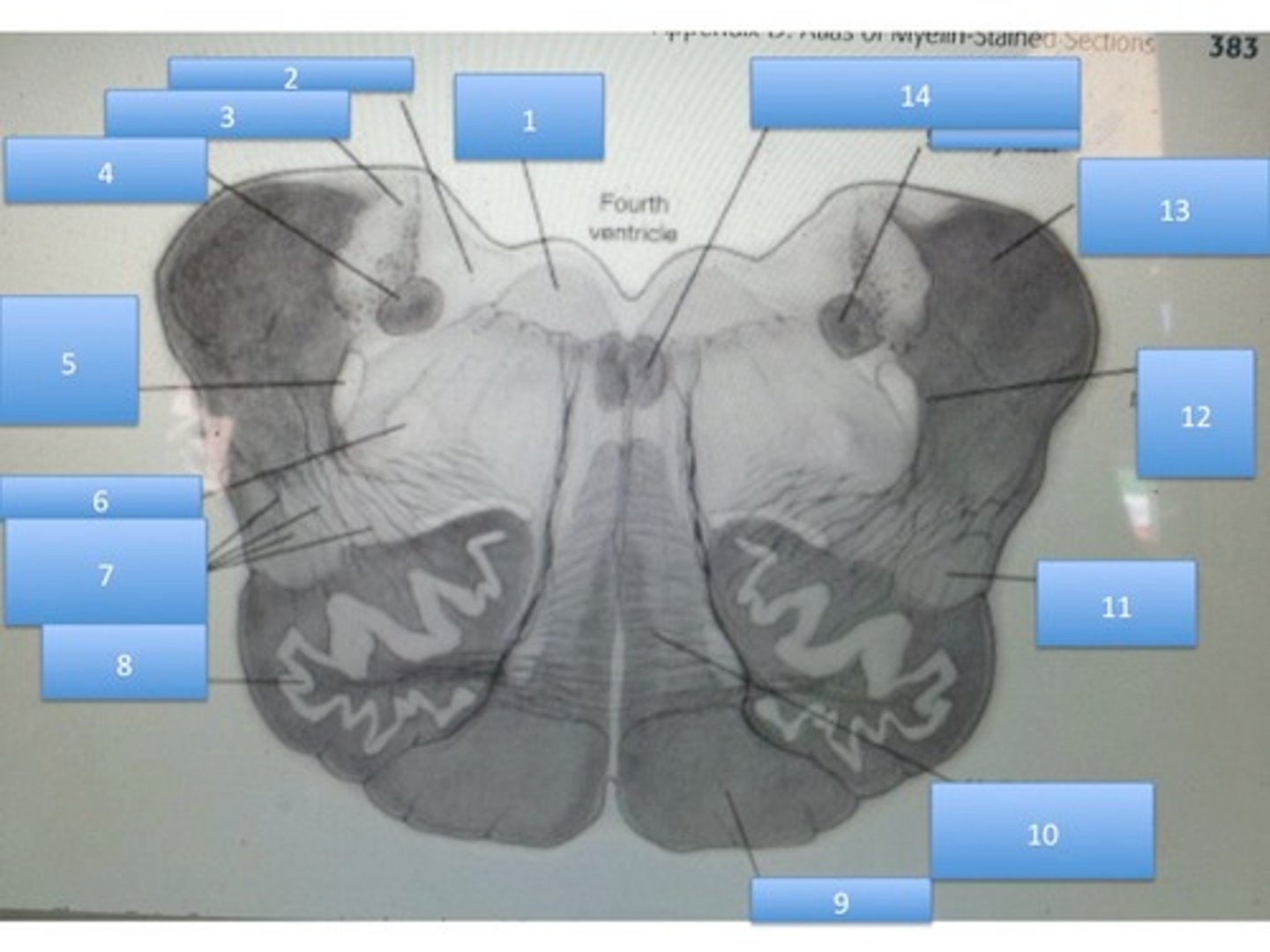 knowt flashcard image