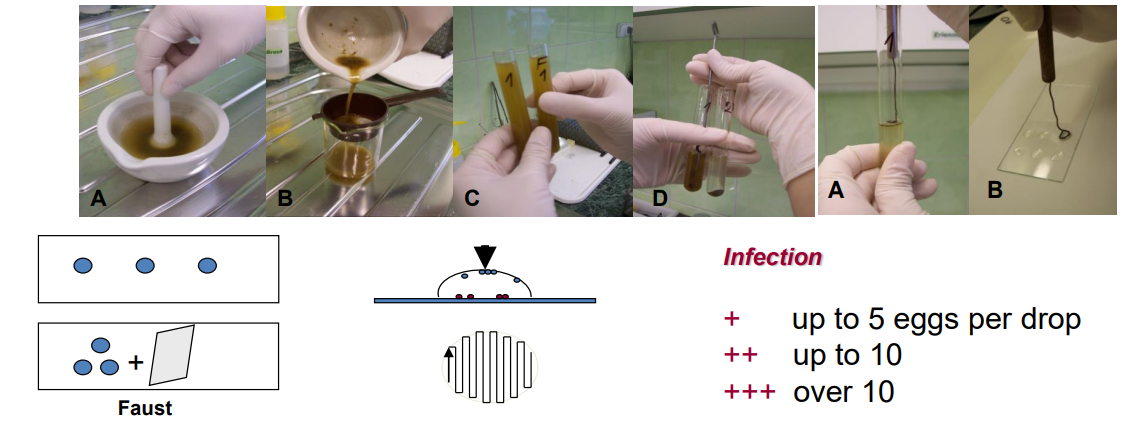 <p><strong>Direct smear</strong> - suitable for rapid examination. Small amount of feces is placesd on a slide, mixed with drop of water, spread out covered with a slip and examined directly.</p><p><strong>Flotation method: </strong>depending on mixing of fecal sample with liquid whose specific gravity is greater than the parasite. - using “flotation fluids”.</p><ol><li><p><em>sample preparation: mixing faeces with water → semisolid suspension</em></p></li><li><p><em>filter the suspension by tea strainer</em></p></li><li><p><em>centrifugation</em></p></li><li><p><em>add flotation solution, filling 1/3</em></p></li><li><p><em>resuspend the sediment by metallic stick</em></p></li><li><p><em>centrifugation</em></p></li><li><p><em>microscopy: take parasitological loop to take 3 drops from surface of tube, put on glass slide. </em></p></li></ol><p></p>