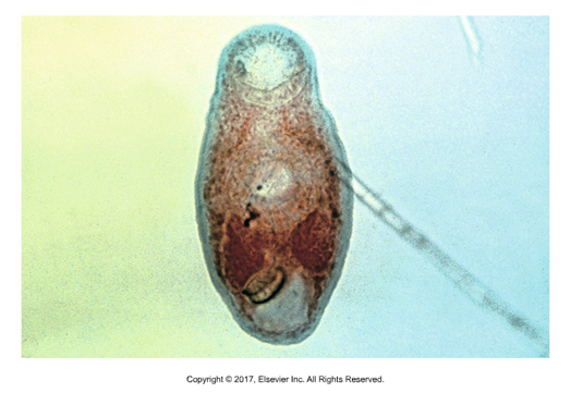 <p>“Salmon poisoning fluke”​</p><ul><li><p>Affects: Dogs</p></li><li><p>1st intermediate host: freshwater snail​</p></li><li><p>2nd intermediate host: salmon​</p></li><li><p>Found: In the Pacific Northwest of N. America​</p></li><li><p>Zoonotic​</p></li><li><p>Adult in small intestine, vector for Rickettsia bacteria causing Elokomin fluke fever​</p></li><li><p>Smallest fluke at only 1.1mm in length, white or cream in color</p></li></ul><p></p>