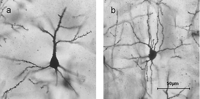 <p>in cells in central nervous system</p>