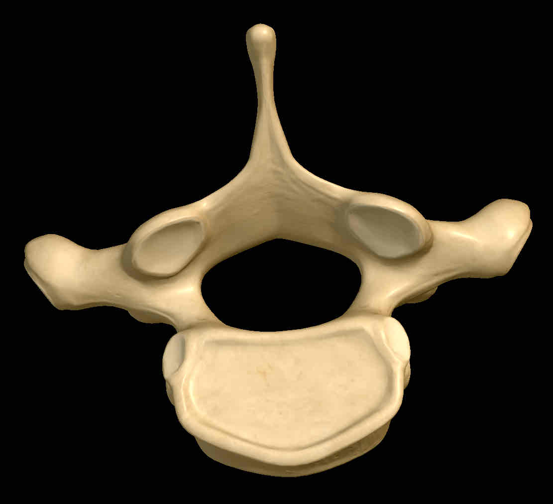 <p>Name this vertebrae</p>