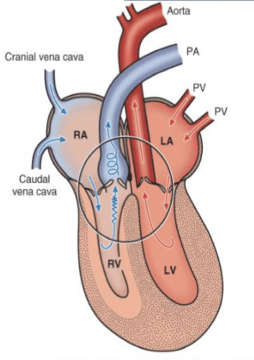 <p>Describe the hemodynamics of pulmonic stenosis</p>