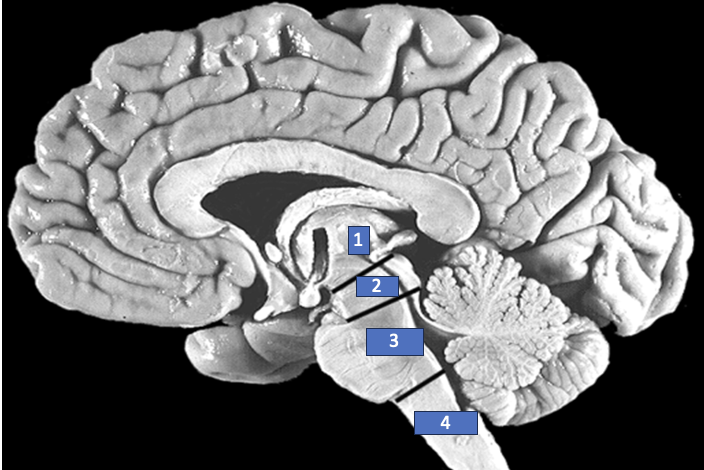 <p>What structure is labeled 1?</p>