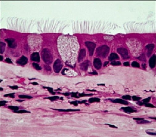 <p>What is the function of the pseudostratified ciliated columnar epithelium?</p>