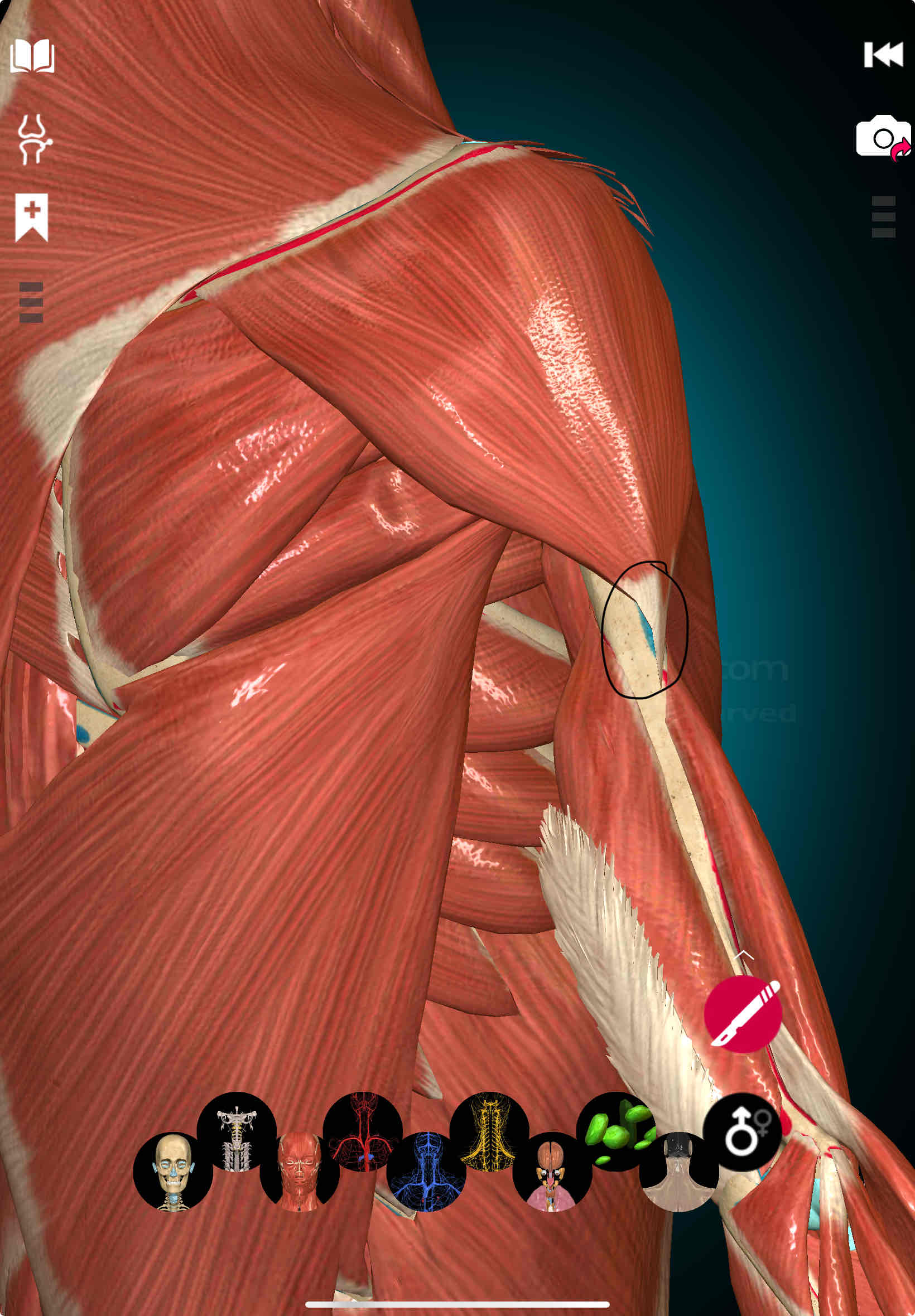 <p>Deltoid Insertion </p>