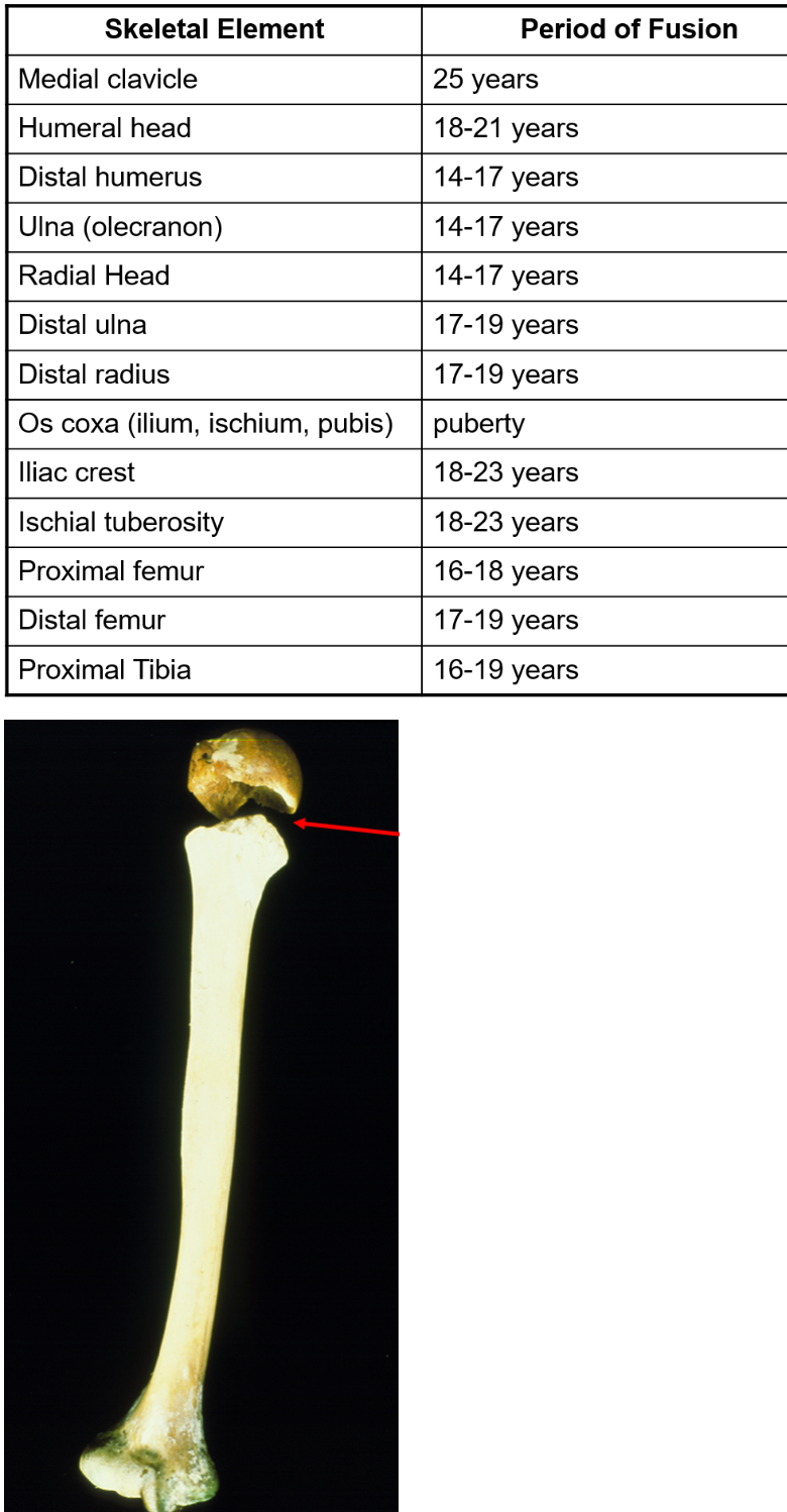 <p><span>This individual was likely younger than 18-21 years old, true or false.</span></p>
