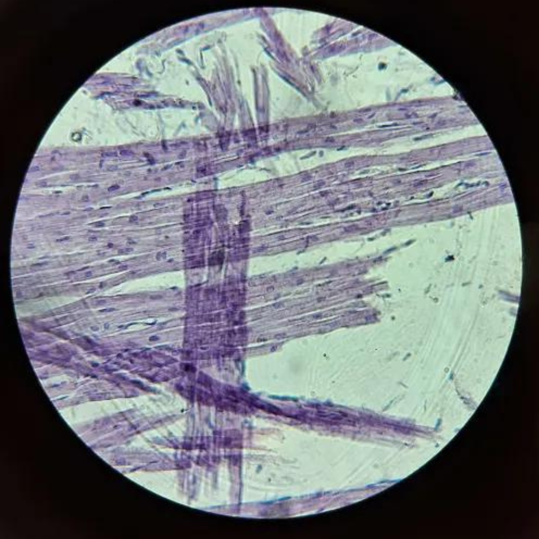 term image