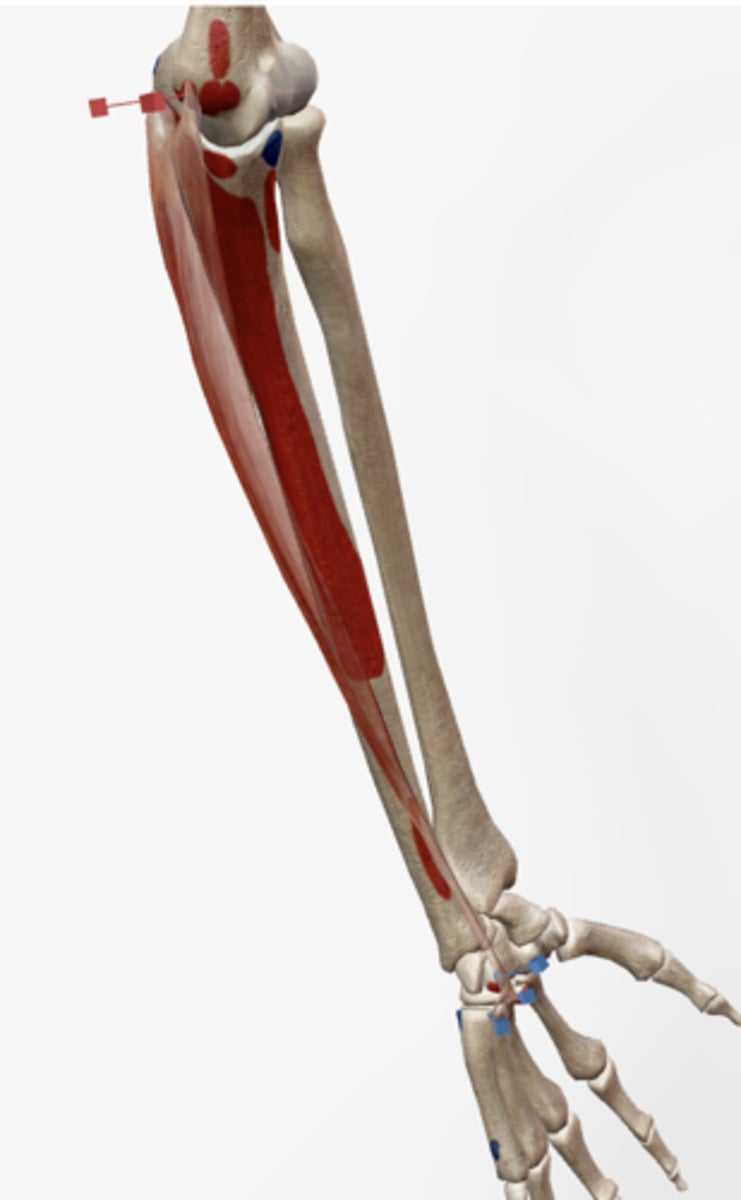 <p>Medial epicondyle of the humerus (humeral head), olecranon of the ulna (ulnar head).</p>