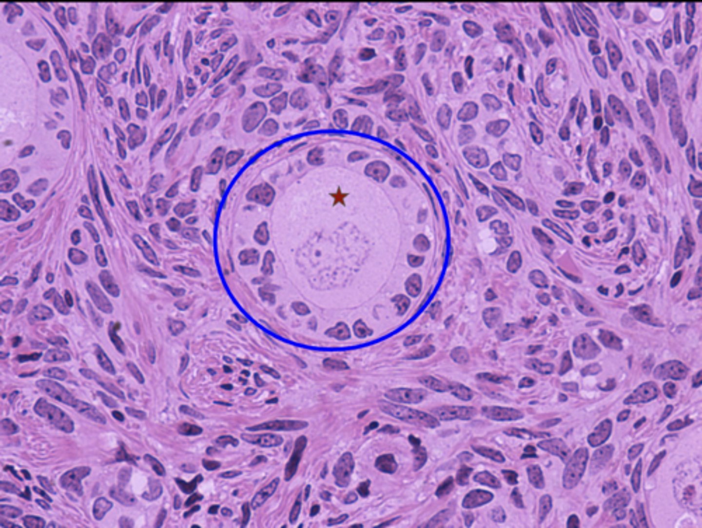 <p>What is the red star?</p>