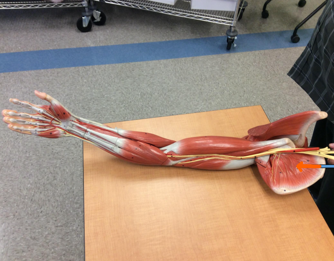 <p>Identify this muscle?</p>