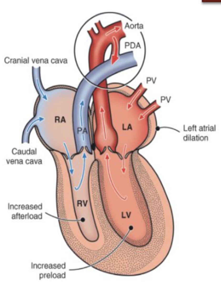 <p>Describe the hemodynamics of rare cases of PDA</p>