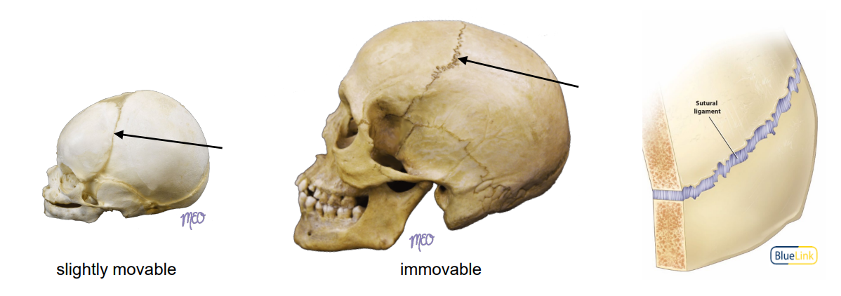 <p>Joint specific to the <strong><u>skull</u></strong> where bones are close together and joined by <strong><u>sutural ligaments</u></strong></p>