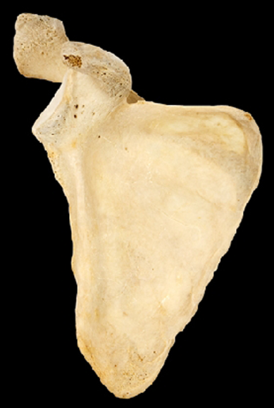 <p>Name this bone.</p><p>Left or right?</p><p>(Anterior view).</p>