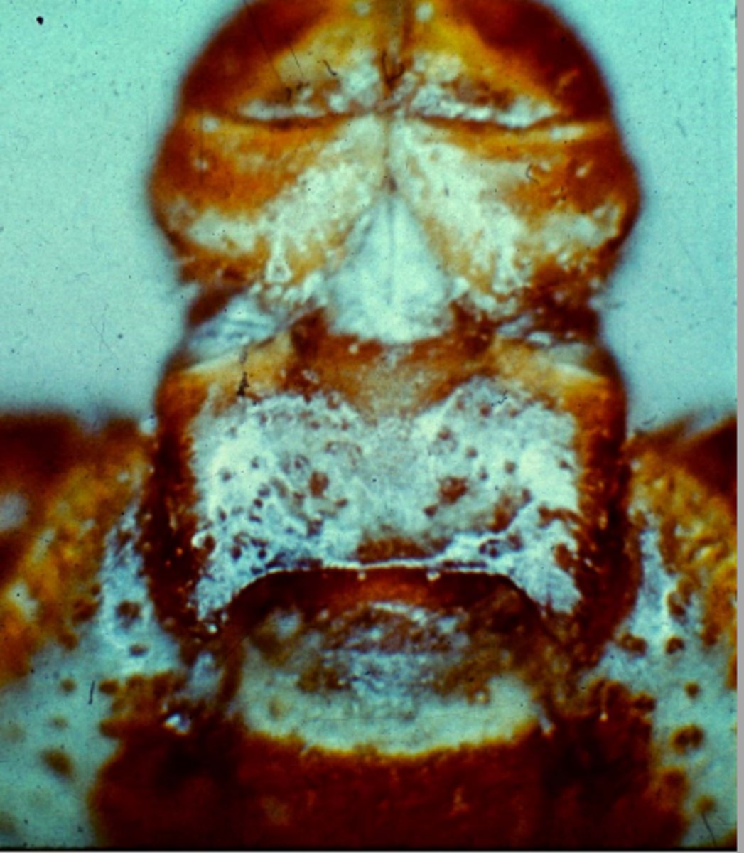 <p>What is the parasite represented in this image?</p>