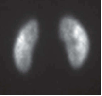 <p>What type of scan is this? </p><p>What organ system is it imaging?</p>