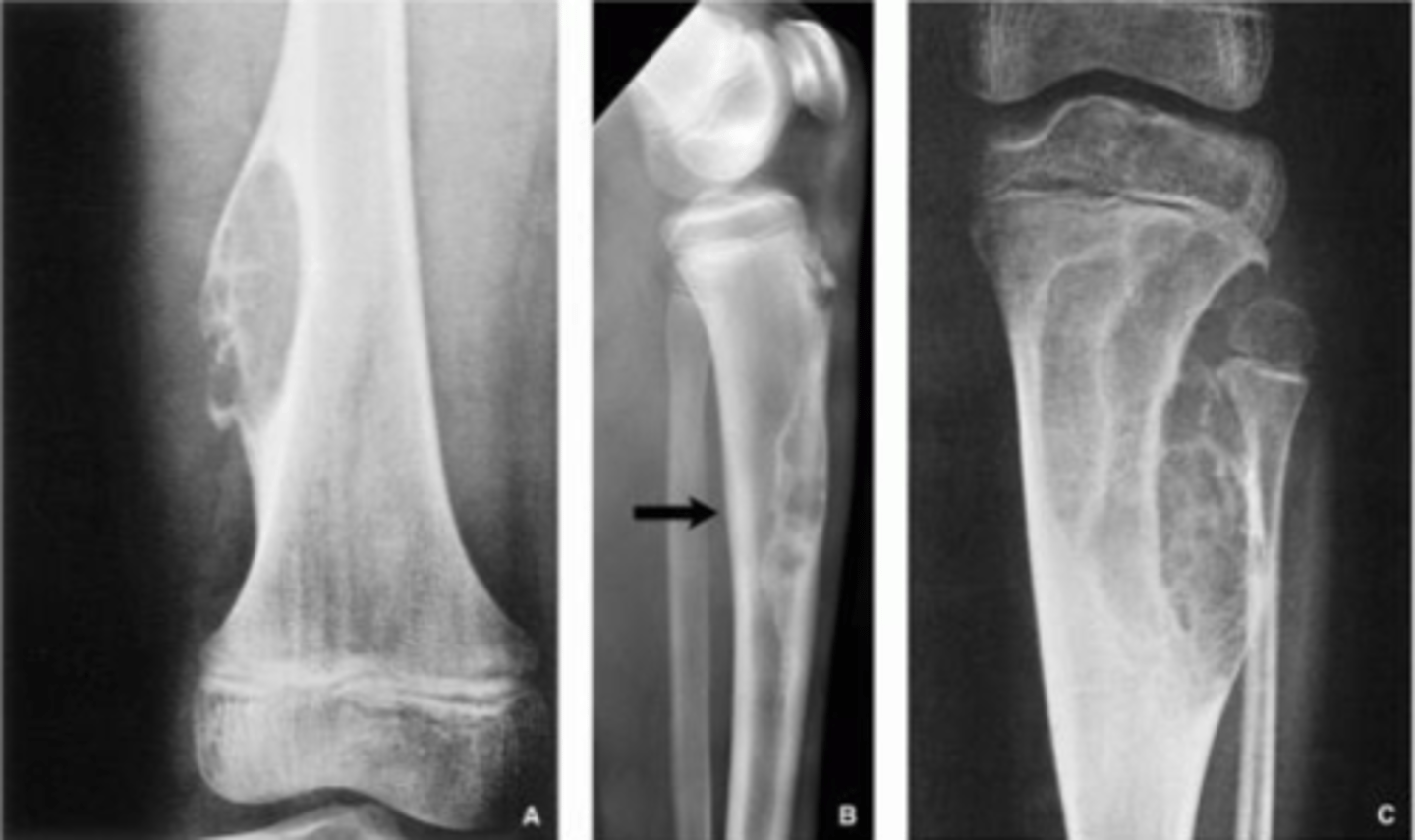 <p>These are examples of ...</p>