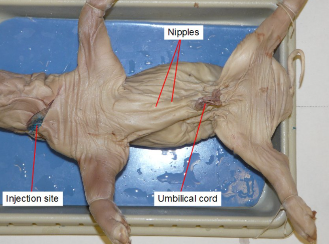<p>a lifeline for a developing fetus, connecting it to the placenta and providing nutrients and oxygen.</p>
