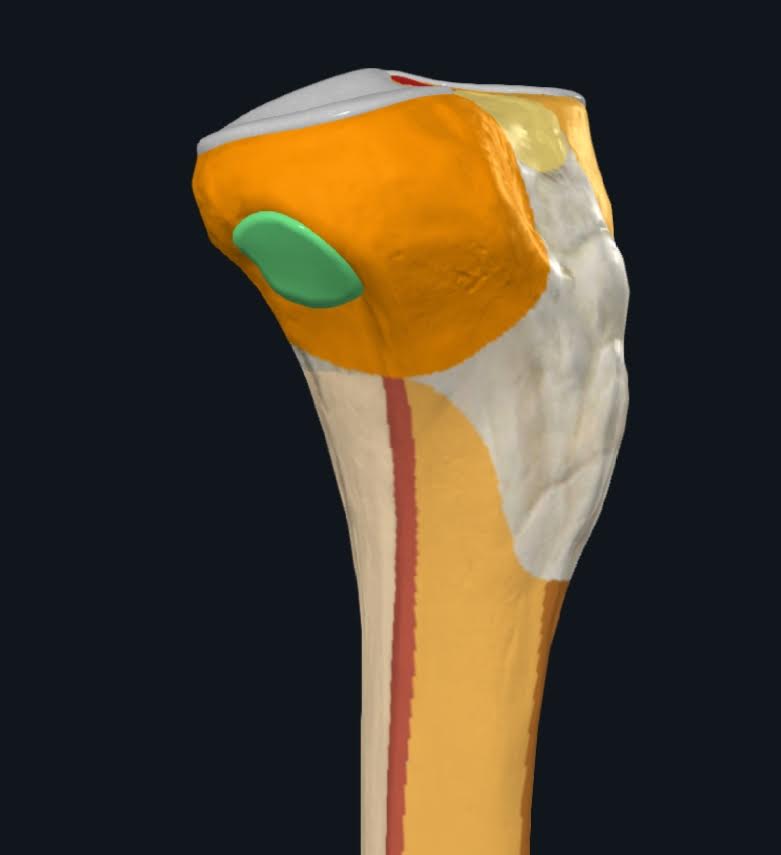 <p>Cara articular del cóndilo lateral de la tibia, donde se inserta la cabeza de la fíbula</p>