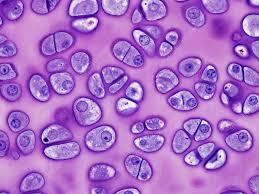 <p>Mature cartilage cell occupying a lacuna.</p>