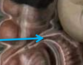 <p>A sphincter muscle situated at the junction of the ileum and the cecum,  which <strong>controls the flow of chyme</strong> from the small intestine into the large intestine and prevents backflow.</p>