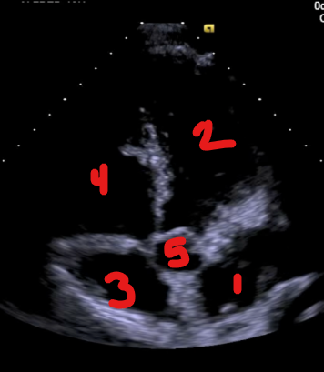 <p>Identify this image. </p>