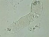 <p><span>This structure is observed in a urine sediment from a dog on 10X. This structure is formed in the renal tubules of the kidneys and appears colorless, transparent, and has rounded ends. It is primarily composed of protein. What is the structure?</span></p>