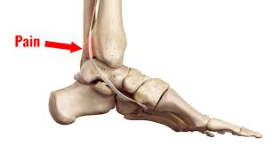 <p>Origin of Flexor Digitorum Longus</p>