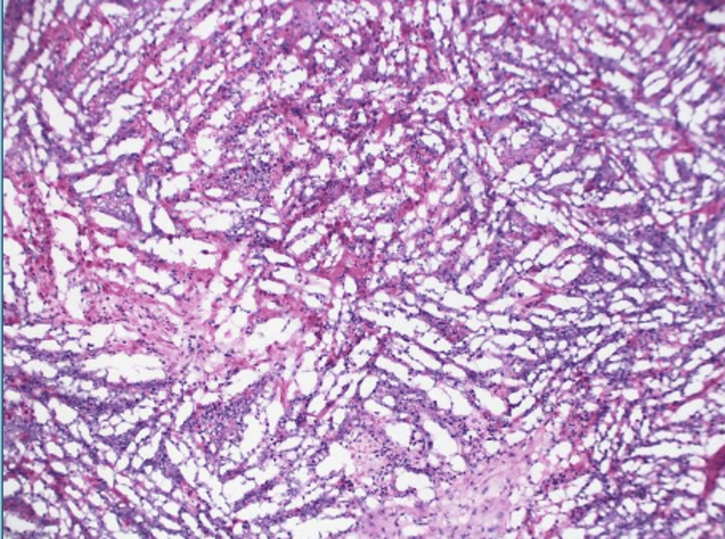 <p>What histological artifact?</p>
