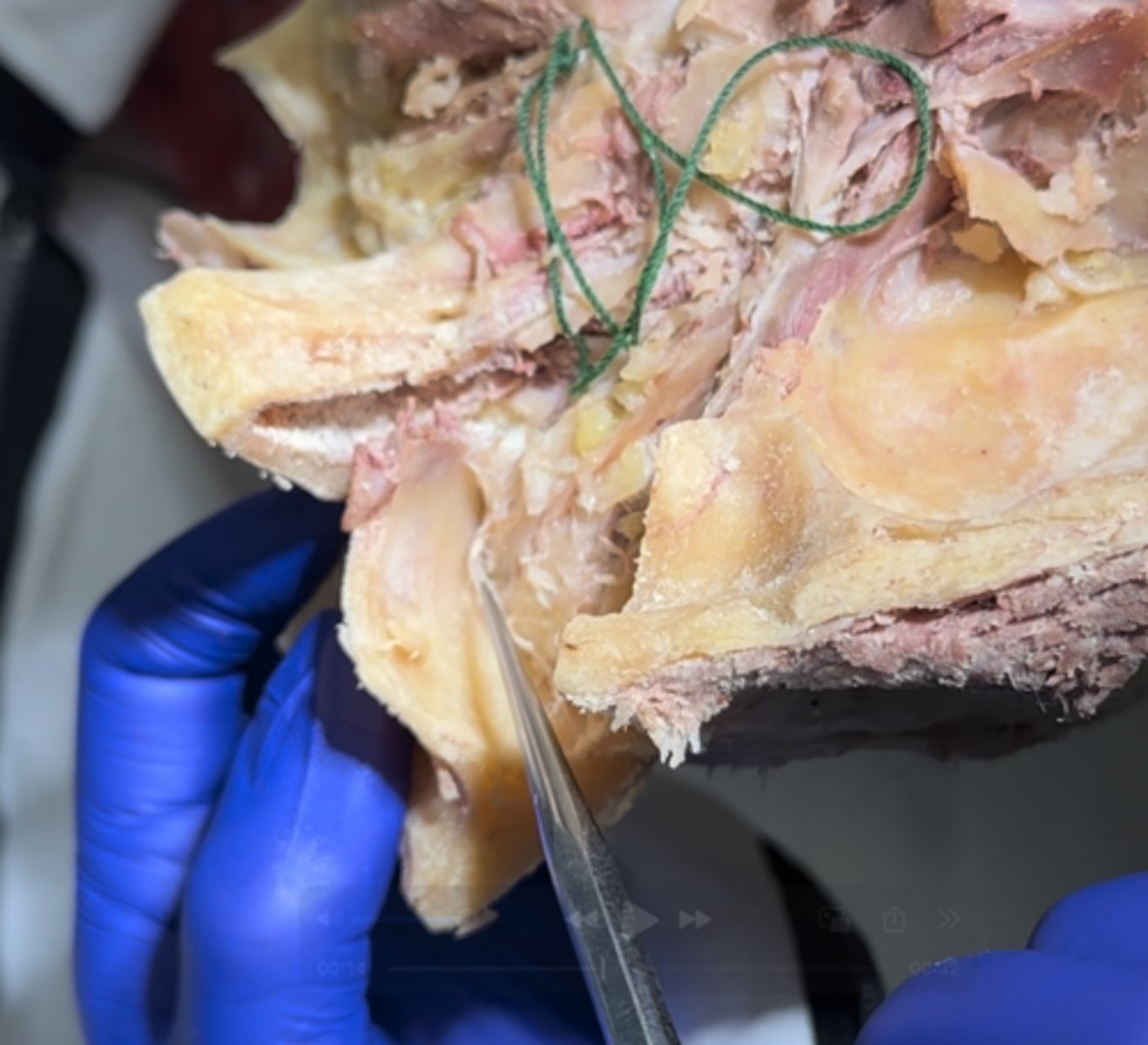 <p>The thin layer covering shown is the</p>