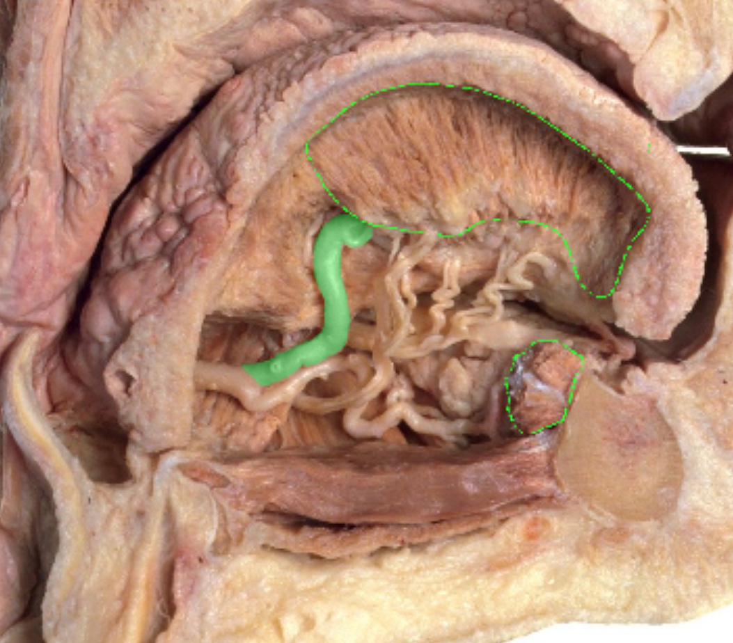 <p>Which artery?</p>