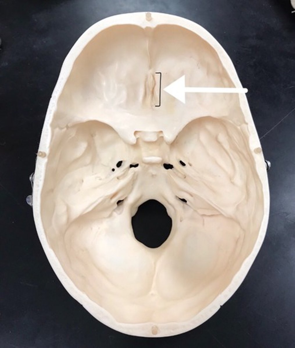 <p>What bone is this?</p>