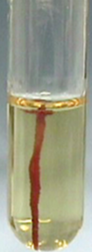 <p>Is this a positive or negative motility agar test?</p>