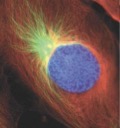 <p>What stage of mitosis?</p>