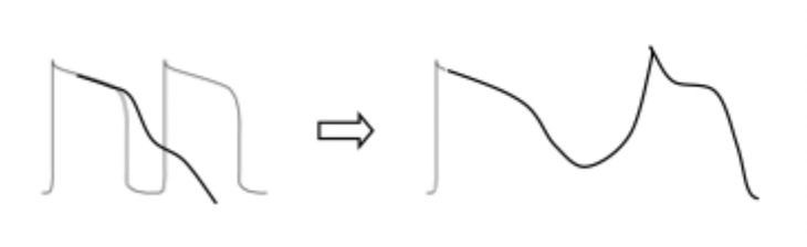 <p>EAD</p>
