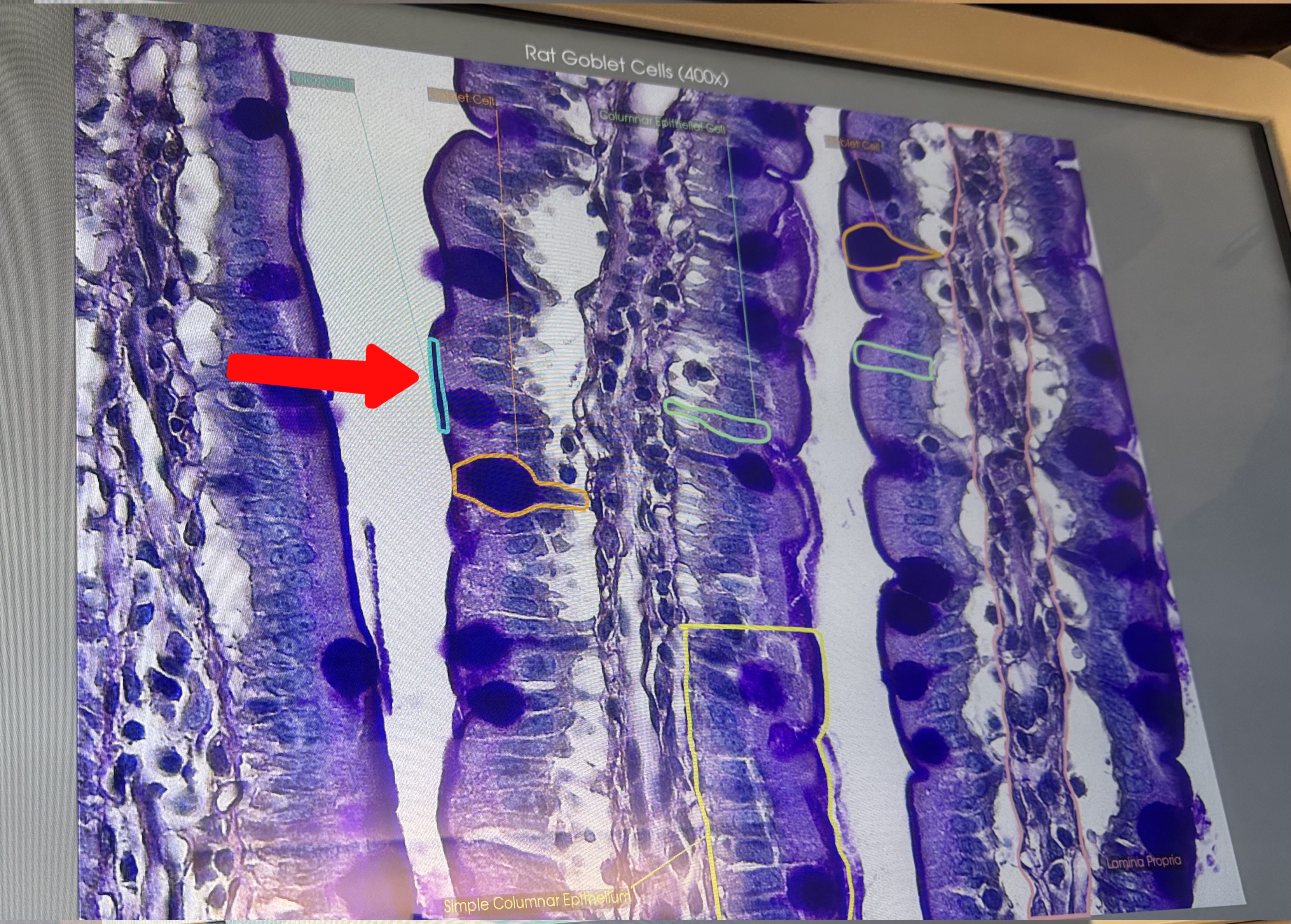 <p>Small intestine 400x (#10068): what is this structure</p>