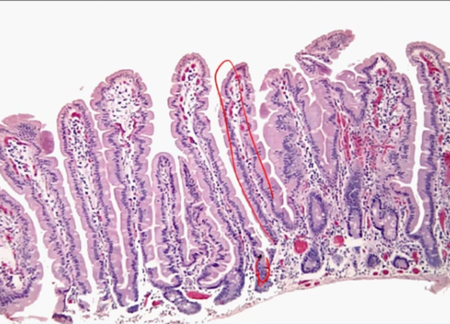 knowt flashcard image