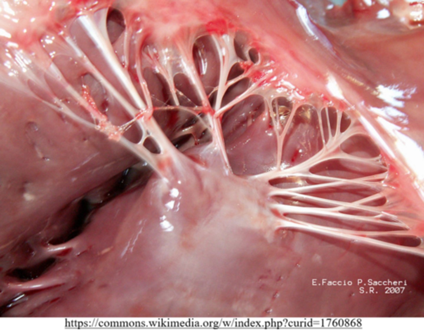 <p>chordae tendineae</p>
