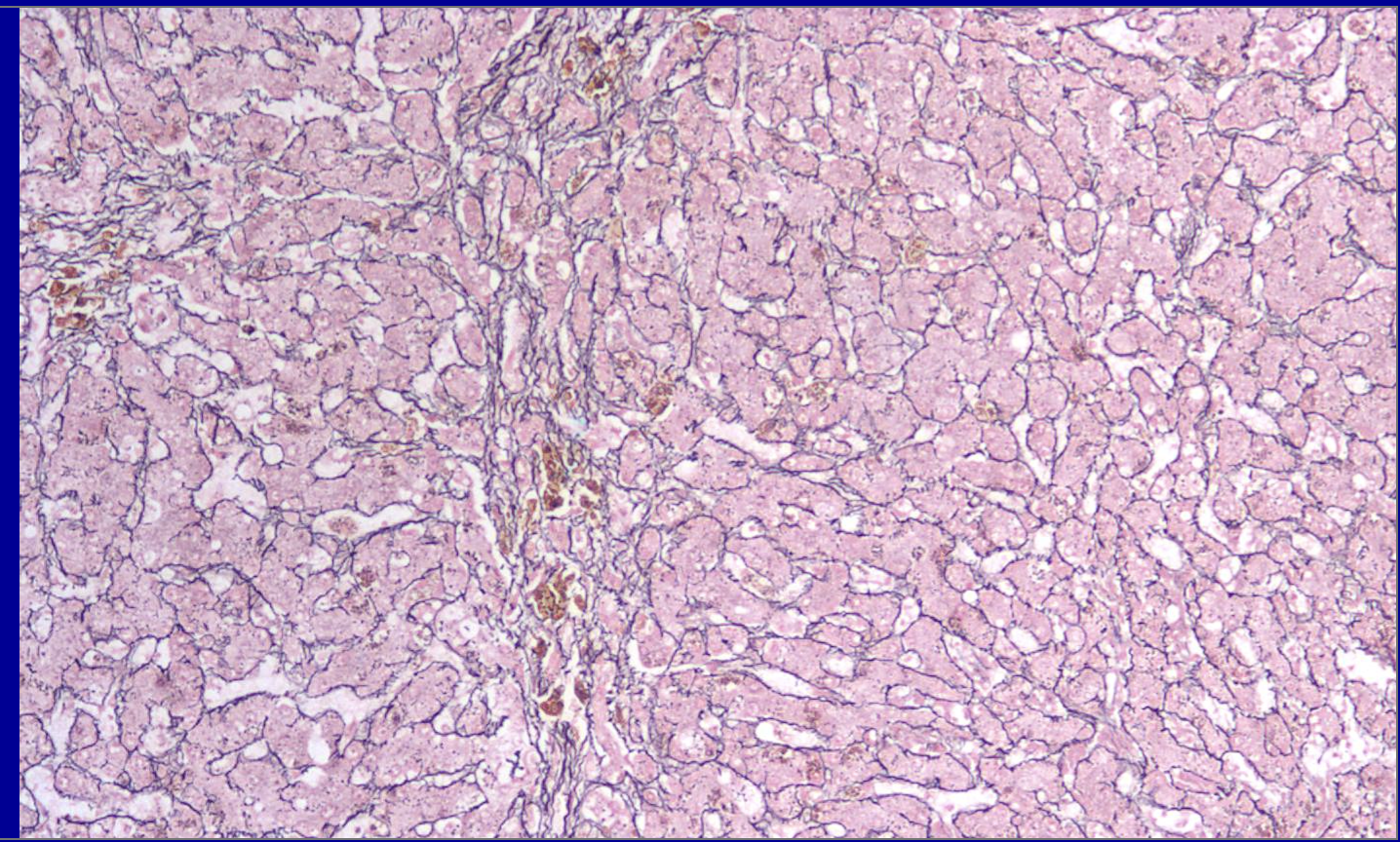 <p>ID the stain type </p>