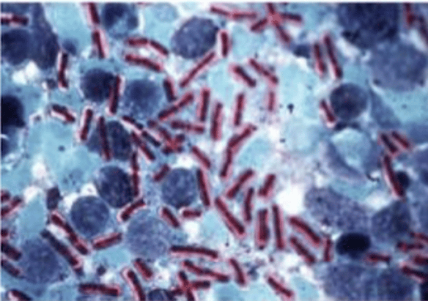 <p>which bacteria looks like this with the methylene blue stain?</p>