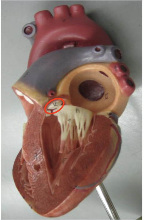 <p>in left atrium diagonally to bicuspid valve first one</p>