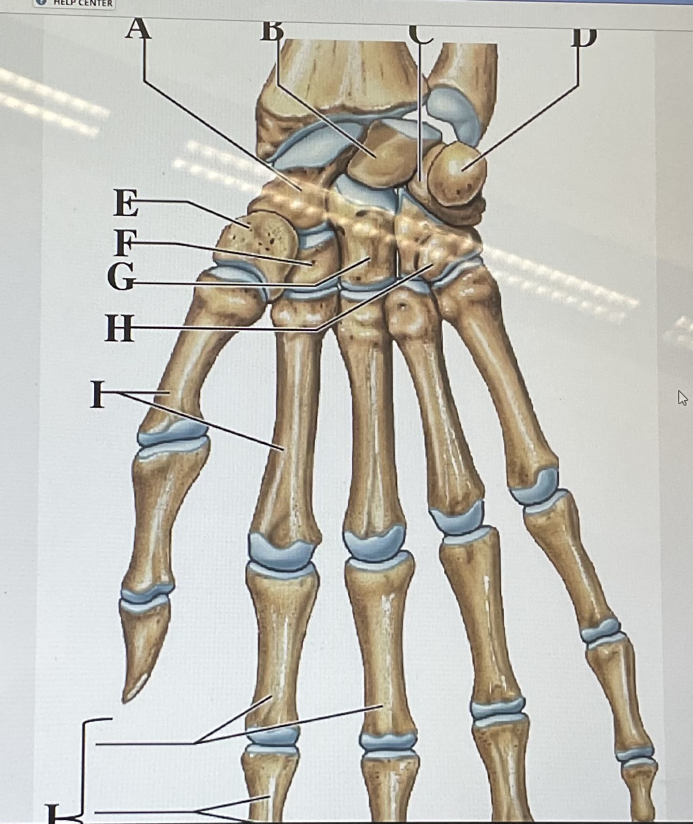 <p>in the figure above letter ___ are the phalanges and letter ____ is the lunate </p>