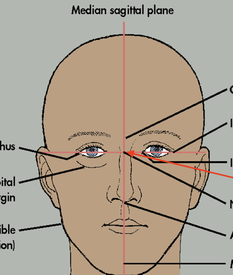 term image