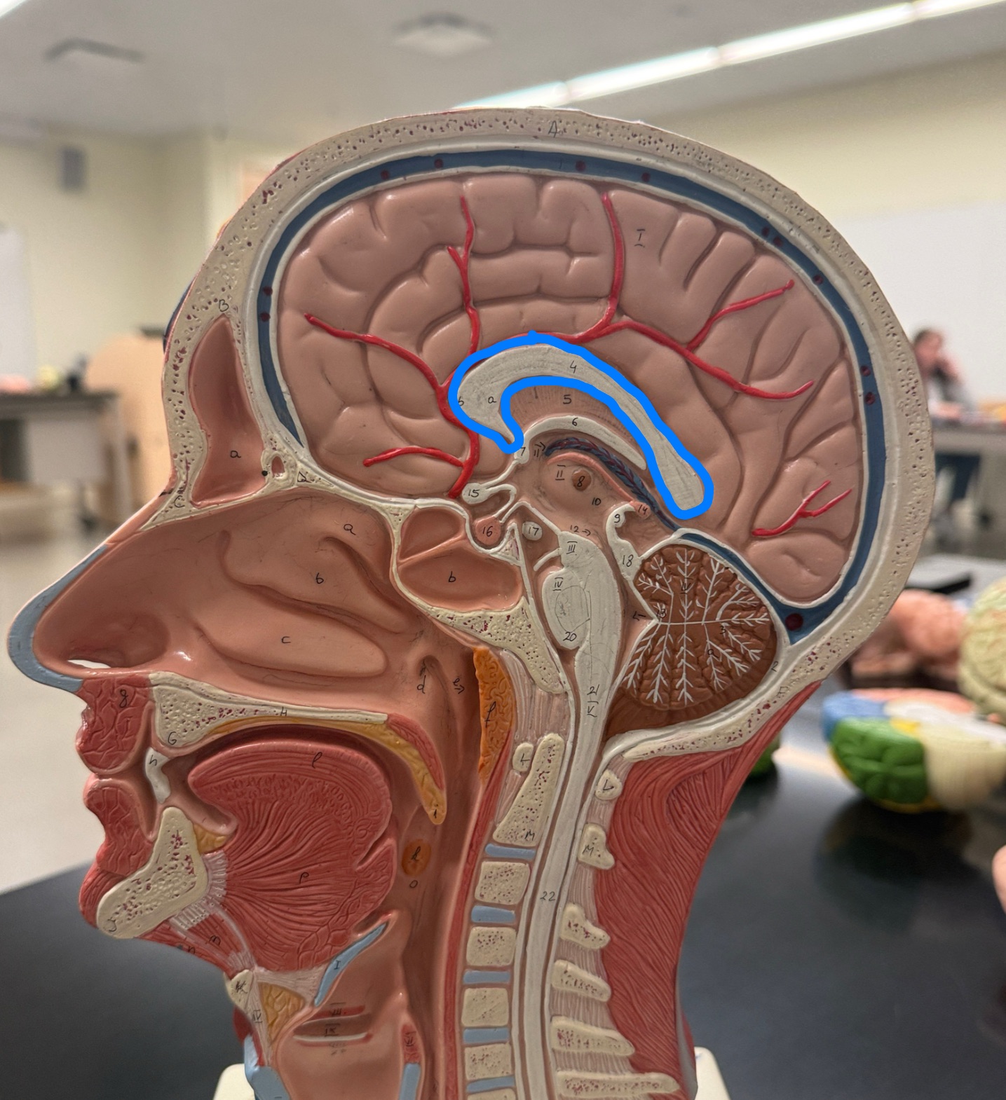 <p>Name what is outlined in blue on the brain model?</p>