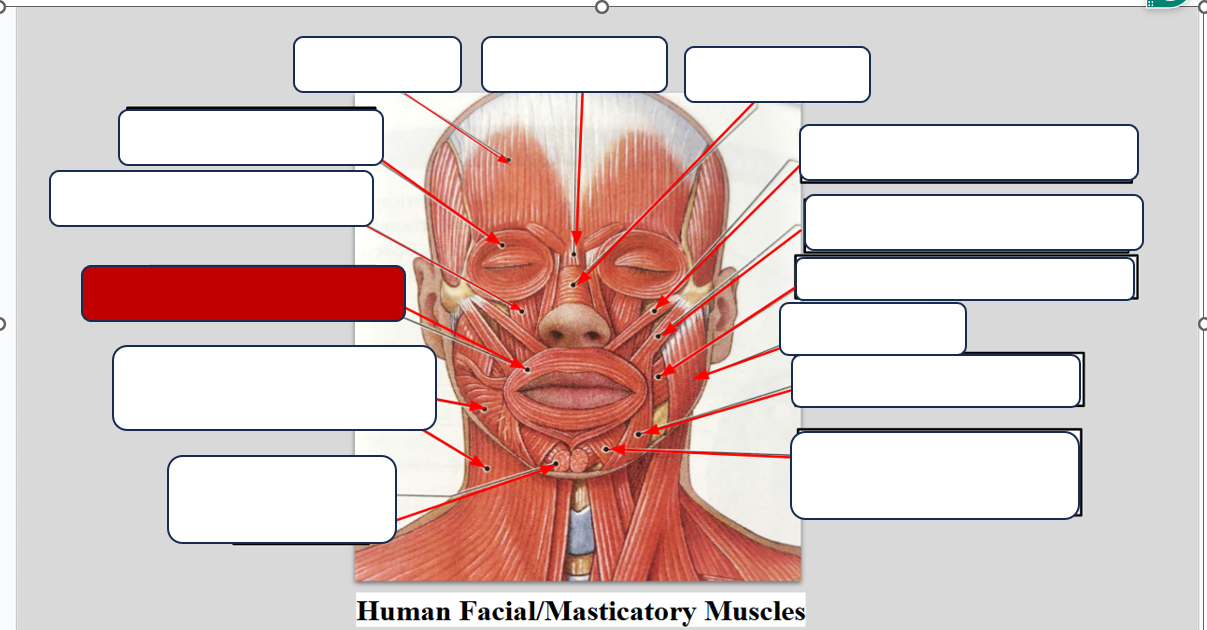 <p>Label the Muscle </p>