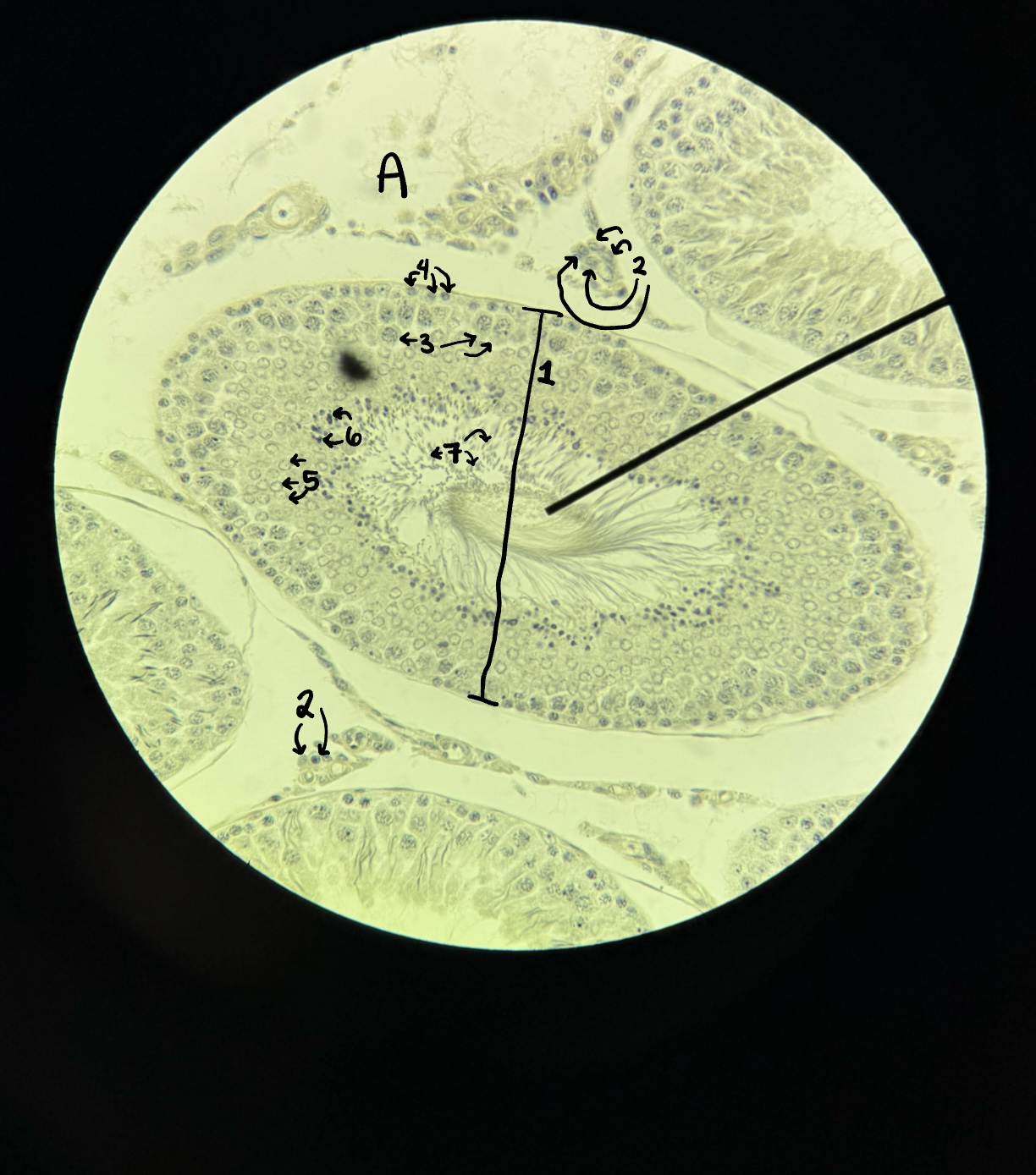 <p>A</p>