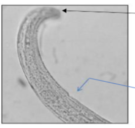 <p>What GIN is shown in this image</p><p>why</p><p>found where</p><p>symptoms of infection</p><p>ppp?</p>