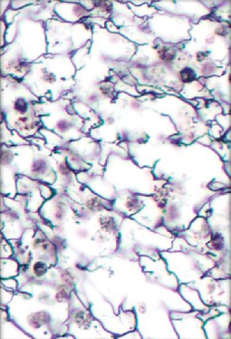 <p>CT Type: CT Proper </p><p>Function: Provides a framework for white blood cells, mast cells, and macrophages - all a part of the immune system </p><p>Location: Lymphoid organs: spleen, lymph nodes, and bone marrow </p><p>Characteristics: Mesh of reticular fibers and fibroblasts</p>