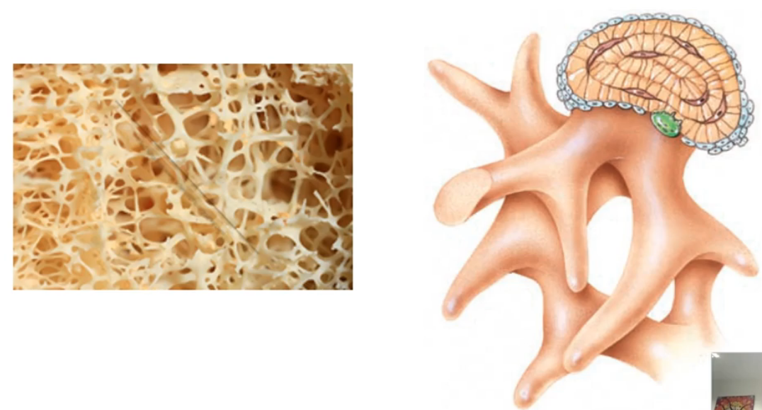 <ul><li><p>Also called<strong> trabecular </strong><span>or&nbsp;<strong>cancellous bone tissue</strong>, there are</span> many <strong>more spaces</strong> between it. This type of osseous tissue is created by a <strong>network of spicules</strong> (trabeculae) that join together</p></li><li><p>There are lots of spaces between these thin trabeculae, making this type of bone <strong>comparatively weaker</strong>. However, this structural make-up is important for a few reasons:</p><ol><li><p>The increased space between the trabeculae makes this bone much <strong>lighter</strong> than compact bone. This means that the bone moves <strong>faster and more easily</strong> when a muscle pulls on it</p></li><li><p>The spaces between the trabeculae house either <strong>red or yellow bone marrow</strong>. This bone marrow contributes to two of the important functions of bone</p></li></ol></li><li><p>Although spongy bone can be considered weaker than compact bone, it can <strong>increase the strength of certain parts of the bone</strong> in many different directions</p></li></ul><p></p>