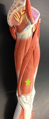 <p><strong>Vastus Medialis</strong> <sub><sup>(mon-articular muscle; anterior compartment of the thigh</sup></sub></p><ul><li><p><span style="color: #2ff916">Origin</span>: Shaft of Femur</p></li></ul><ul><li><p><span style="color: #0db1ff">Insertion</span>: Patella </p></li><li><p><span style="color: #ff0000">Action</span>: <strong>Extend</strong> Knee</p></li></ul><p></p>