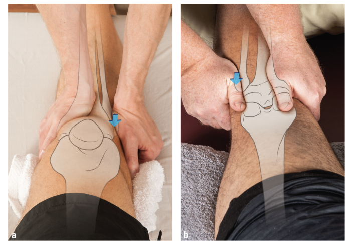 <p>Anteroposterior and Posteroanterior Glides</p>